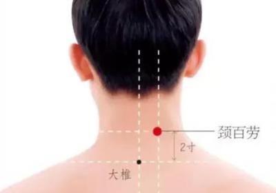 经外奇穴：颈百劳穴