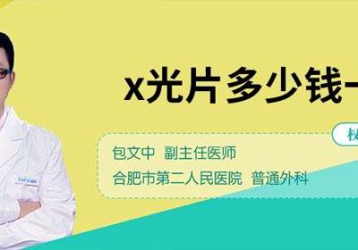 x光片多少钱一次