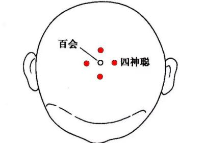 经外奇穴：四神聪穴