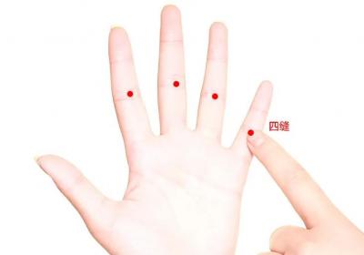 经外奇穴：四缝穴
