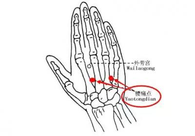 经外奇穴：腰痛点穴