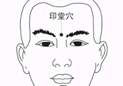 经外奇穴：印堂穴