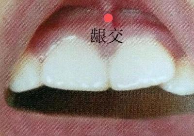 督脉穴位：龈交穴