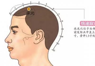 足太阳膀胱经经穴：承光穴