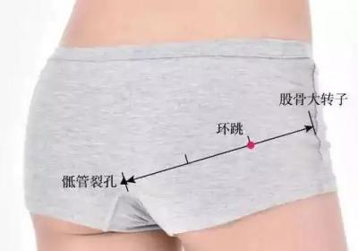 足少阳胆经经穴：环跳穴