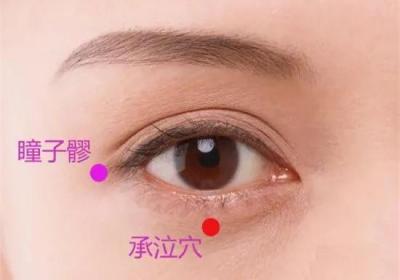 足阳明胃经经穴：承泣穴