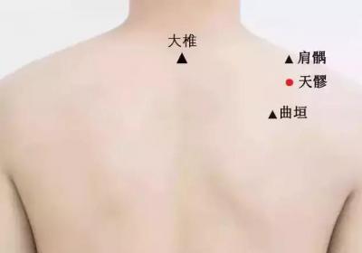 手少阳三焦经经穴：天髎穴
