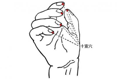 藏在指尖的急救要穴，脑中风急救穴位——十宣穴