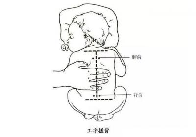 小儿保健——工字搓背法