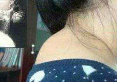 富贵包——夺命包，再不重视就晚了！