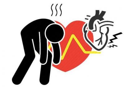 心脏猝死的高危人群和预警症状，你有必要了解这些知识