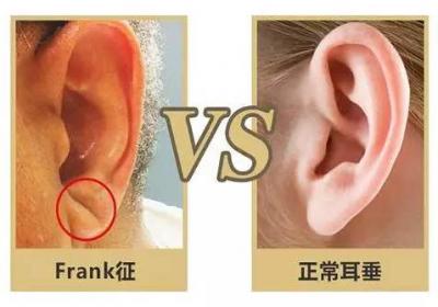 身体有某些疾病，在这里会有显示！