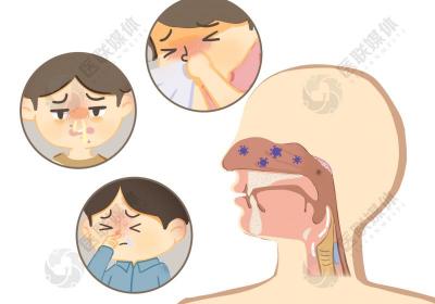 过敏性鼻炎“甩不掉”？针灸治疗有妙招