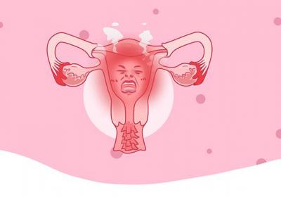 白头翁散可以治子宫炎吗