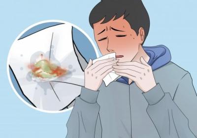 气管炎的症状和表现有哪些