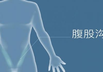 腹股沟在哪个位置