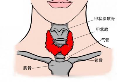 白头翁可以治疗甲状腺吗