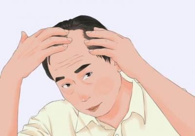 白头翁可以治疗脱发吗