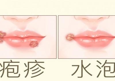 上火能吃羊肉吗
