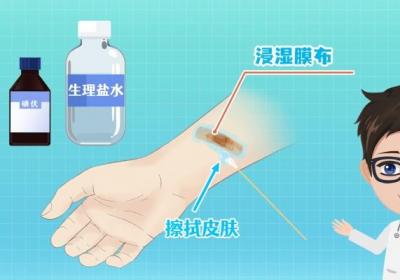 碘酒和碘伏一样吗