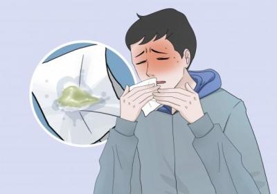 白痰是宣肺还是清肺