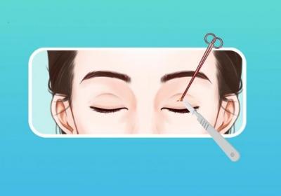 眼部手术要多少钱