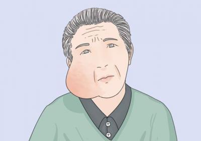 消耗性疾病有哪些