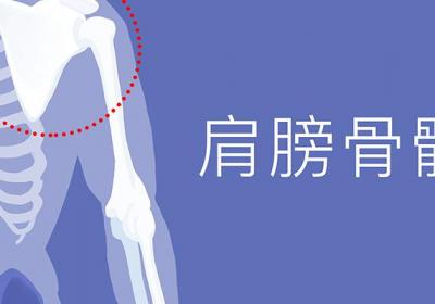 左肩膀酸痛是怎么回事