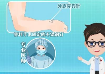 哈尔滨哪家医院看骨科好