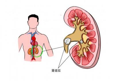 吃木耳菜的禁忌是什么
