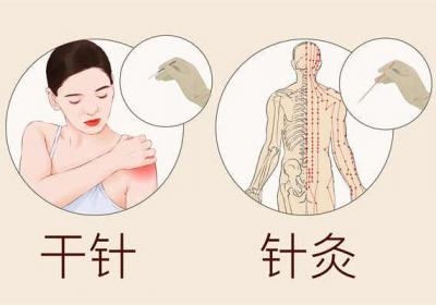 针灸的危害
