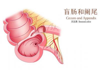 阑尾炎不能吃什么