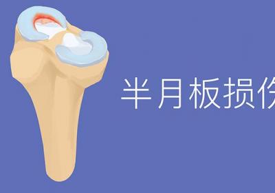 半月板撕裂怎么治疗最好