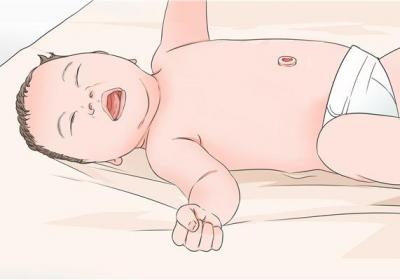 新生儿败血症严重吗
