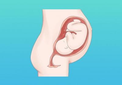 胎儿股骨长71个子矮吗