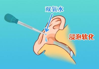 双氧水和碘伏的区别