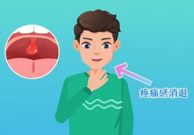 扁桃体炎是什么症状