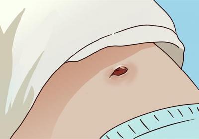 肚脐眼上面疼是什么原因