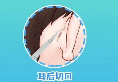 耳后淋巴结肿大