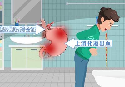 消化道是什么
