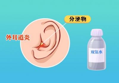 耳朵耳屎怎么清理
