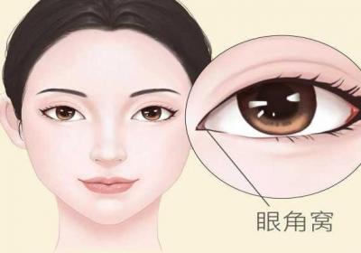 5种妙招缓解眼睛疼痛