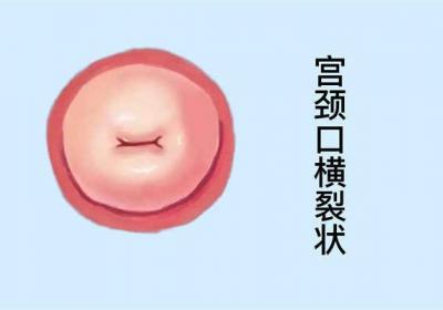 宫缩是什么感觉的
