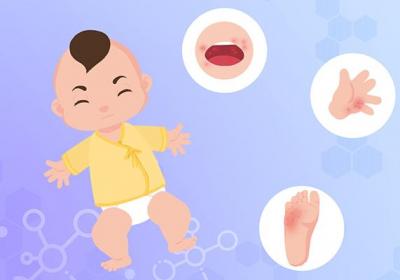 手足口病通过什么传播
