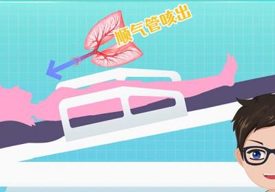 三伏贴治疗气管炎
