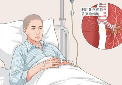 一般化疗第几次最痛苦