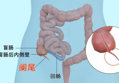 阑尾在哪个位置