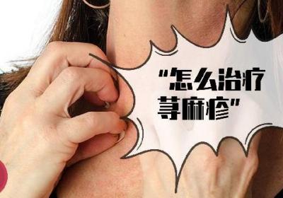 慢性荨麻疹有什么好的中医治疗方法