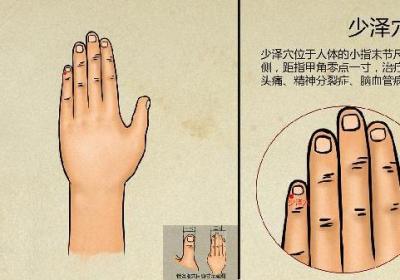 中医脂溢性脱发病因