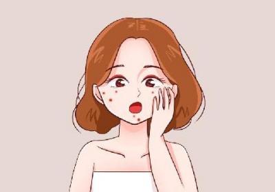 后脑勺长痘痘是肝火还是肾火